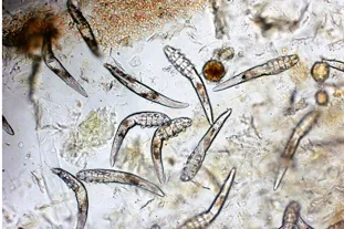 Servizio di visite dermatologiche